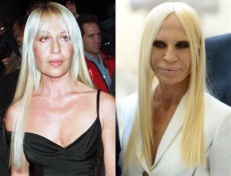 donatella versace cirugias|donatella versace without plastic surgery.